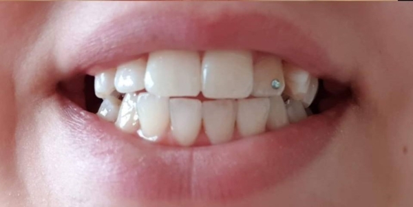 Få forskellige hos Tandlægerne Løgstør